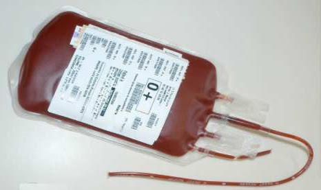 Concentré de Globules Rouges (https://www.toutsurlatransfusion.com/actualite-transfusion-et-don-du-sang/impasse_transfusionnelle.php)