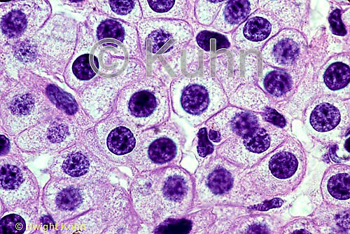 Observation microscopique grossie 400x de cellules de foie d'amphiuma. Une coloration rose/violette est utilisée  our mettre en exergue le noyau cellullaire (des gros points en violet foncé)