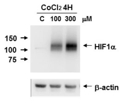 Résultats d'une expérience de western blot ciblant la protéine HIF1-alpha (source : https://images.novusbio.com/images2/HIF-1-alpha-Antibody-Western-Blot-NB100-449-img0015.jpg)